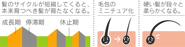 脱毛の仕組み